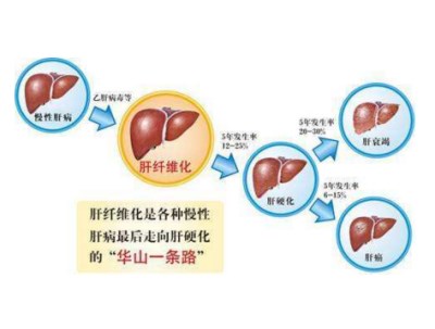 全自動(dòng)生化分析儀廠家可檢測肝功的這些項(xiàng)目—山東國康