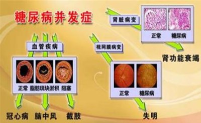 國產(chǎn)生化分析儀提醒預(yù)防腎病糖尿病，一定要定期檢查-山東國康