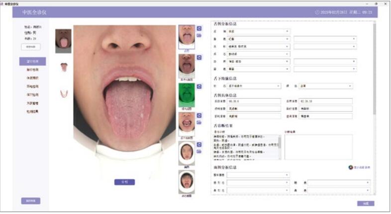 （中醫(yī)全診儀）舌面脈經(jīng)穴信息采集管理系統(tǒng)（二代）舌診采集頁(yè)面.jpg