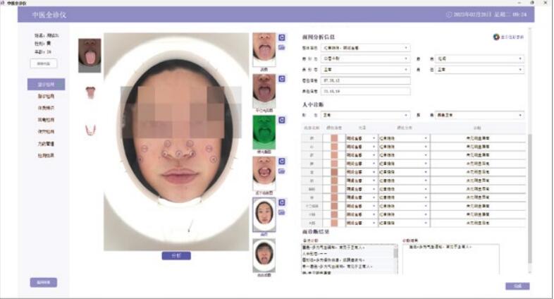 （中醫(yī)全診儀）舌面脈經(jīng)穴信息采集管理系統(tǒng)（二代）面診采集界面.jpg
