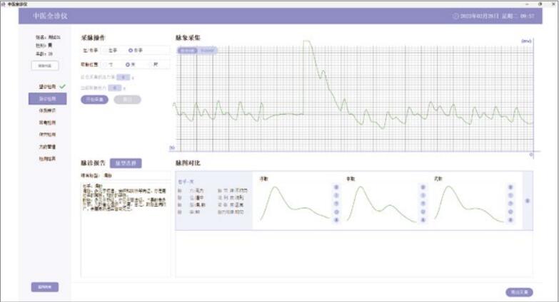 （中醫(yī)全診儀）舌面脈經(jīng)穴信息采集管理系統(tǒng)（二代）切診采集界面.jpg