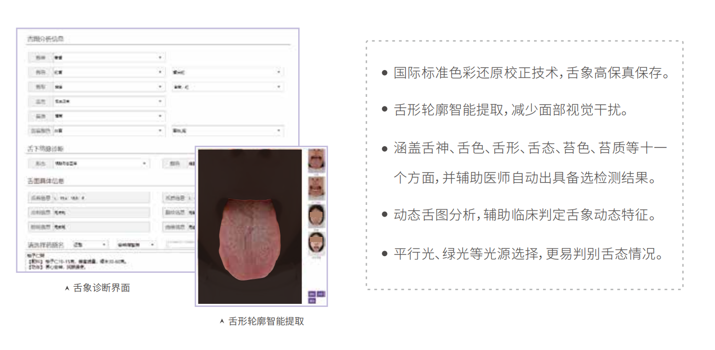 舌診儀（中醫(yī)舌象信息采集管理系統）MT-SX-02舌象分析特點.png